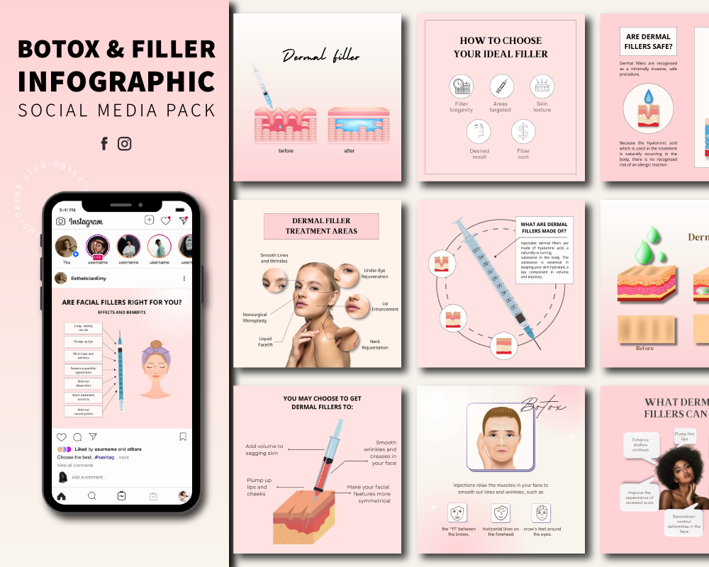 BOTOX & FILLER INFOGRAPHIC Pink Pack